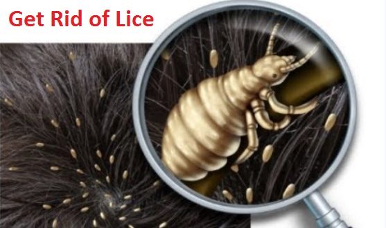 how-to-get-rid-of-lice-fast