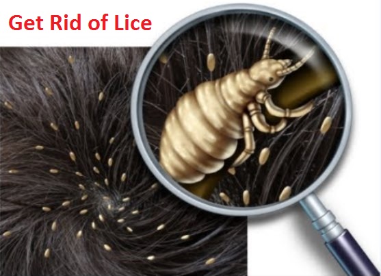 Get Rid of Lice Fast