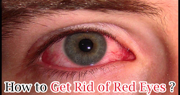 How to Get Rid of Red Eyes?