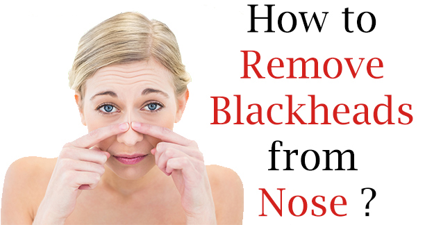 How to Remove Blackheads from Nose