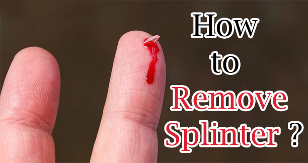 How to Remove Splinter