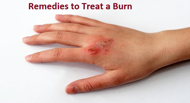 Remedies to Treat a Burn