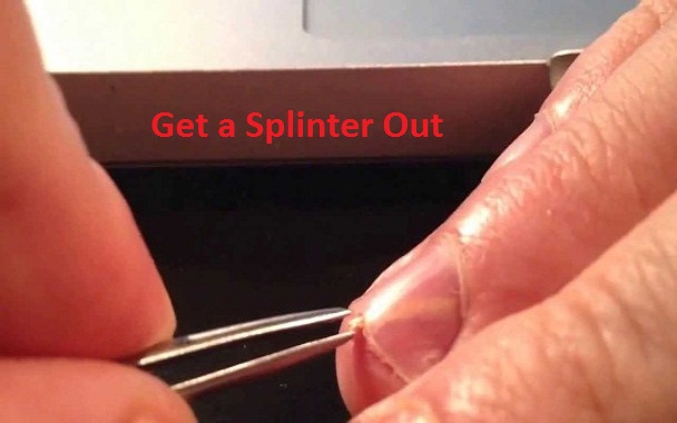  Get a Splinter Out