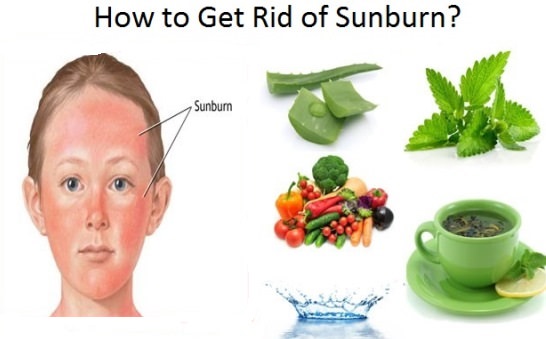 Get rid of sunburn