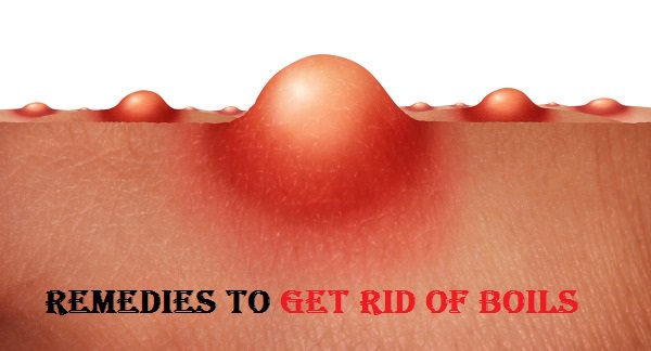 get rid of boils