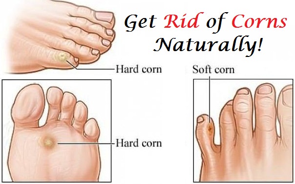 how to get rid of corns