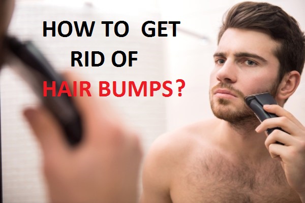 HOW TO GET RID OF HS BUMPS