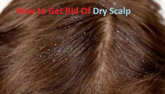 how to get rid of dry scalp