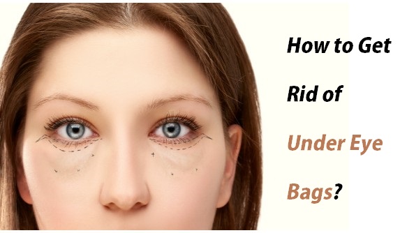 How to Get Rid of Under Eye Bags