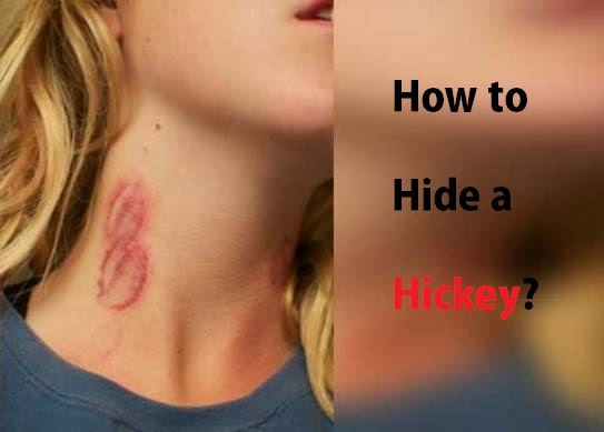 How to Hide a Hickey?