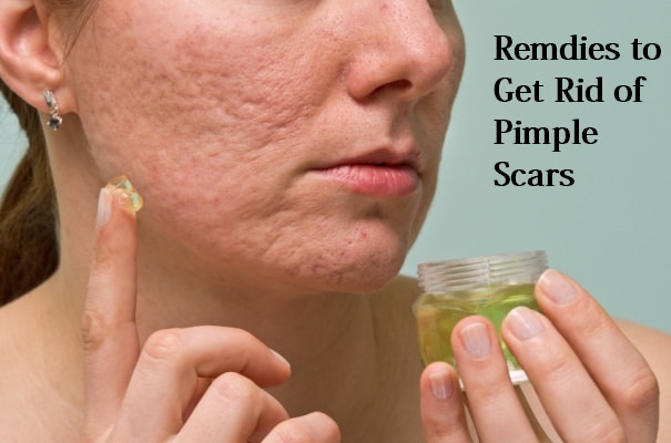 get rid of pimple scars